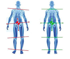 Superthotics a 39,99€