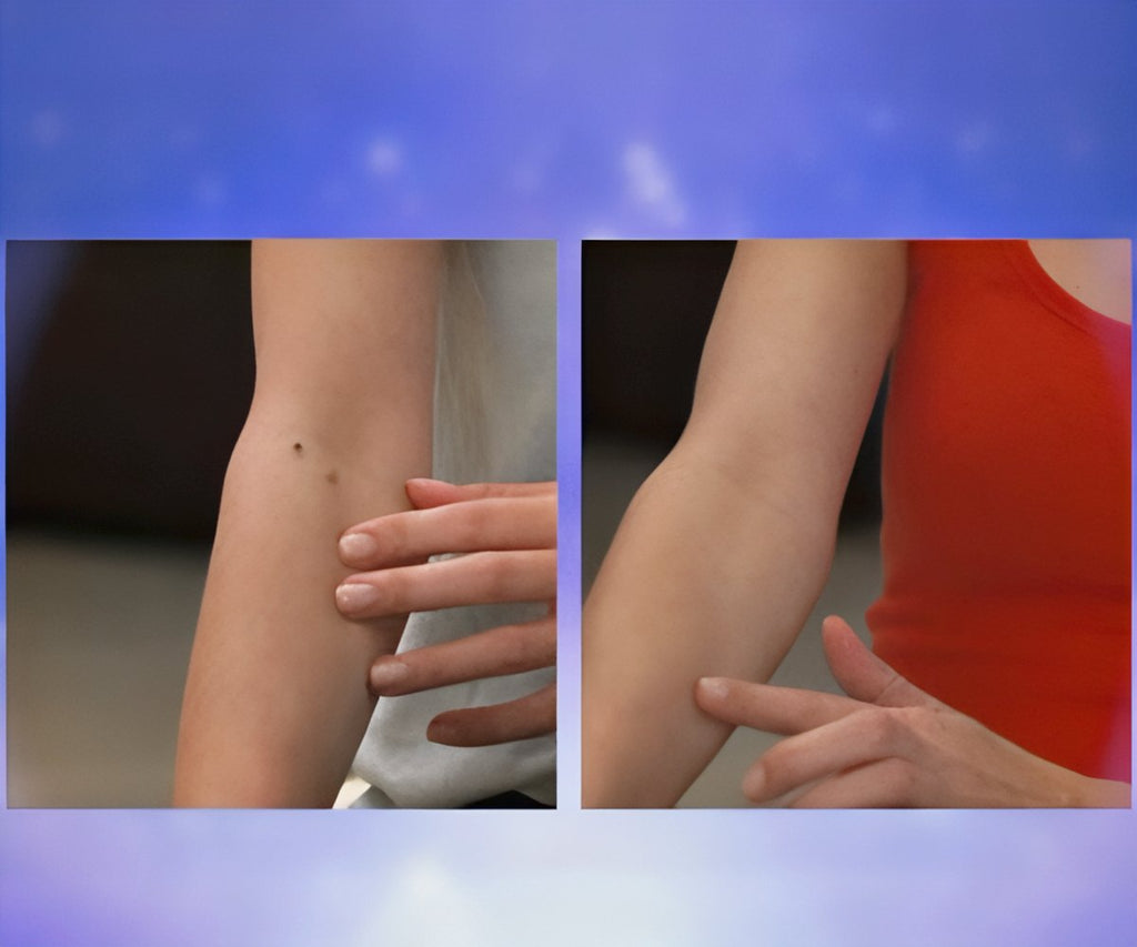 Skin Patch 2x1 a 49,99€